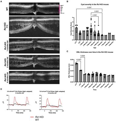 An osmolarity dependent mechanism partially ameliorates retinal cysts and rescues cone function in a mouse model of X-linked retinoschisis